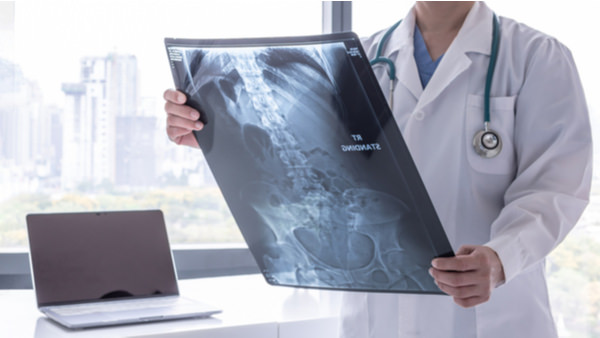 Doctor holding a x-ray